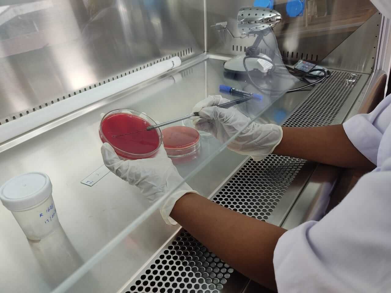 Epidemiology, Diagnosis, and Prognosis of Leptospirosis and Scrub Typhus among Agricultural Workers Hospitalized for Community-Acquired Febrile Illnesses at the National Hospital Galle.